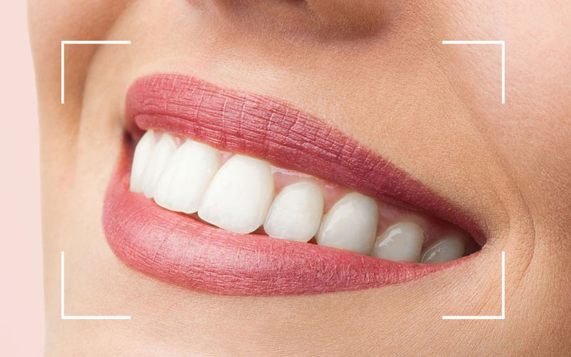 Dentistree Pediatric And Orthodontic Centre